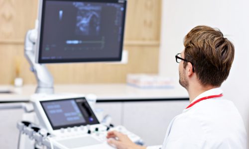 Picture of male doctor using ultrasound machine